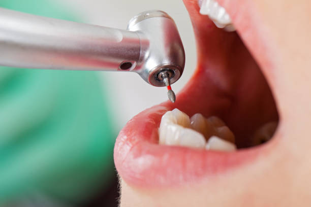Dentist for Dental Trauma in IN